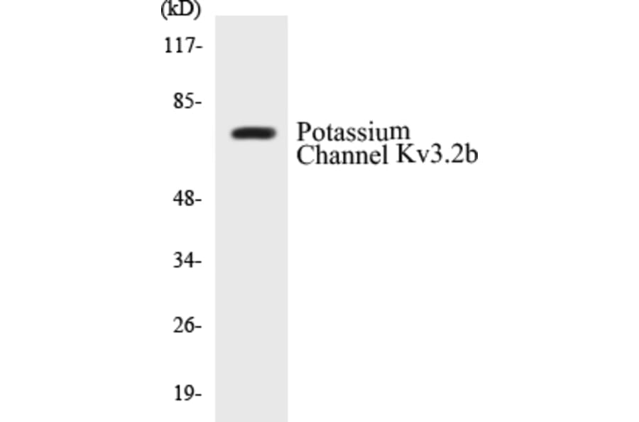 Western Blot - Potassium Channel Kv3.2b Cell Based ELISA Kit (CB5581) - Antibodies.com