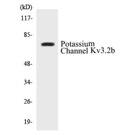 Western Blot - Potassium Channel Kv3.2b Cell Based ELISA Kit (CB5581) - Antibodies.com