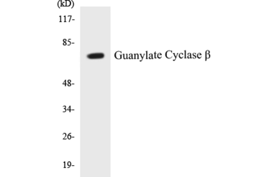 Western Blot - Guanylate Cyclase beta Cell Based ELISA Kit (CB5314) - Antibodies.com