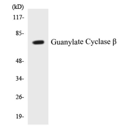 Western Blot - Guanylate Cyclase beta Cell Based ELISA Kit (CB5314) - Antibodies.com