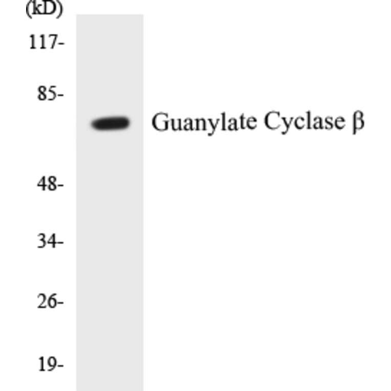 Western Blot - Guanylate Cyclase beta Cell Based ELISA Kit (CB5314) - Antibodies.com