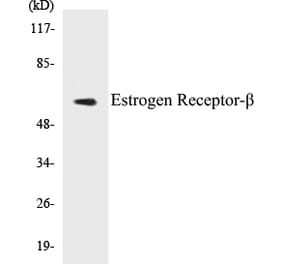 Western Blot - Estrogen Receptor beta Cell Based ELISA Kit (CB5250) - Antibodies.com
