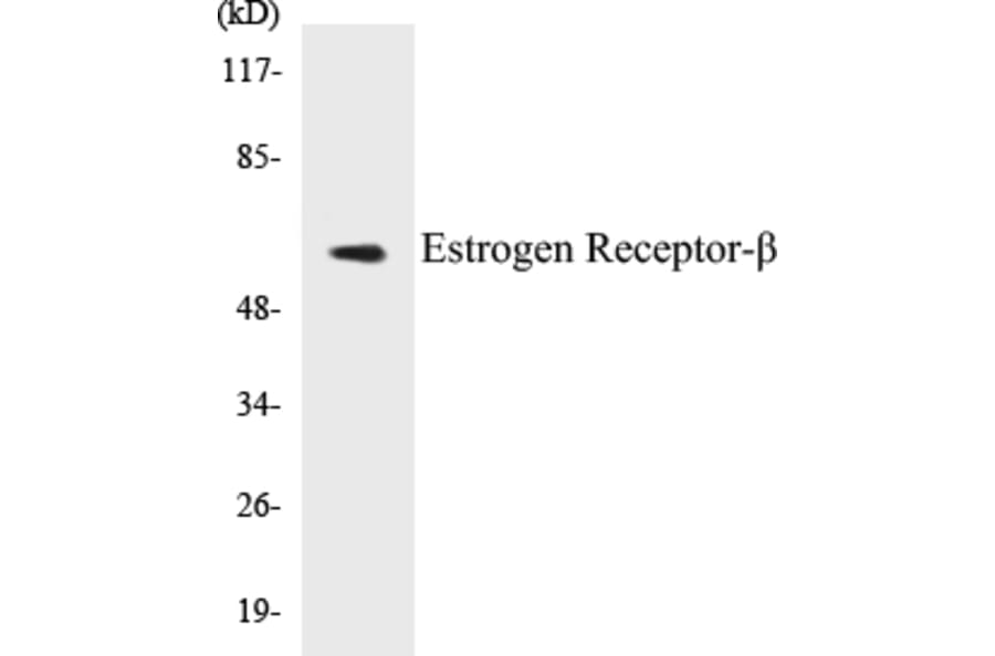 Western Blot - Estrogen Receptor beta Cell Based ELISA Kit (CB5250) - Antibodies.com