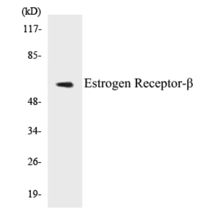 Western Blot - Estrogen Receptor beta Cell Based ELISA Kit (CB5250) - Antibodies.com