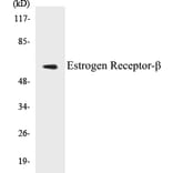 Western Blot - Estrogen Receptor beta Cell Based ELISA Kit (CB5250) - Antibodies.com