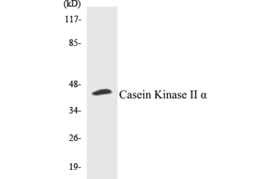 Western Blot - Casein Kinase II alpha Cell Based ELISA Kit (CB5097) - Antibodies.com