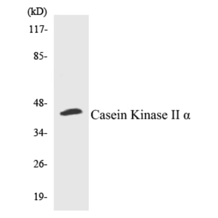 Western Blot - Casein Kinase II alpha Cell Based ELISA Kit (CB5097) - Antibodies.com