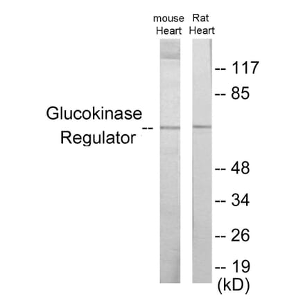 Western Blot - Glucokinase Regulator Cell Based ELISA Kit (CB6002) - Antibodies.com