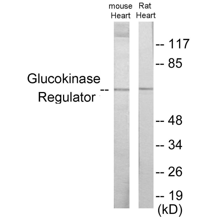 Western Blot - Glucokinase Regulator Cell Based ELISA Kit (CB6002) - Antibodies.com