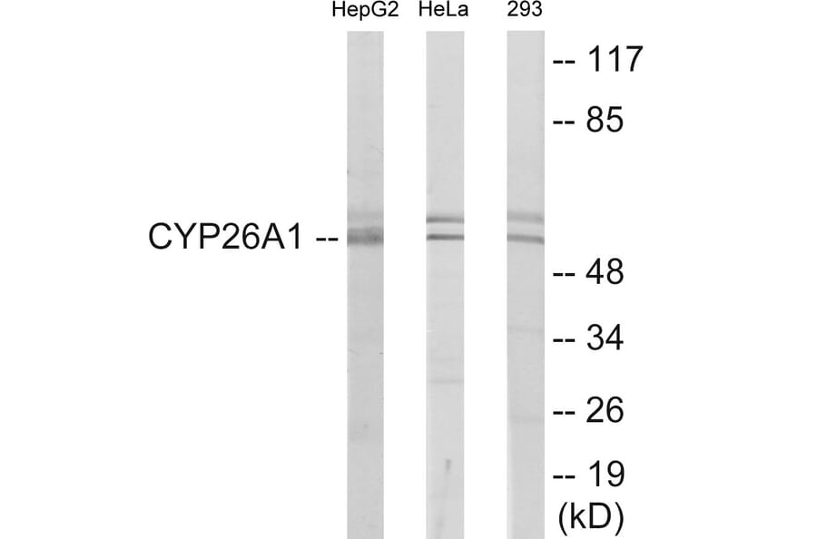 Western Blot - Cytochrome P45 026A1 Cell Based ELISA Kit (CB6125) - Antibodies.com