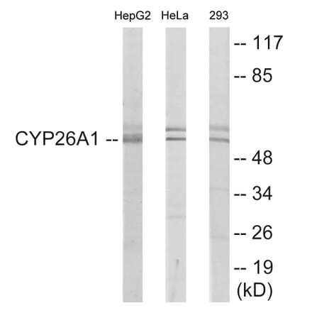 Western Blot - Cytochrome P45 026A1 Cell Based ELISA Kit (CB6125) - Antibodies.com