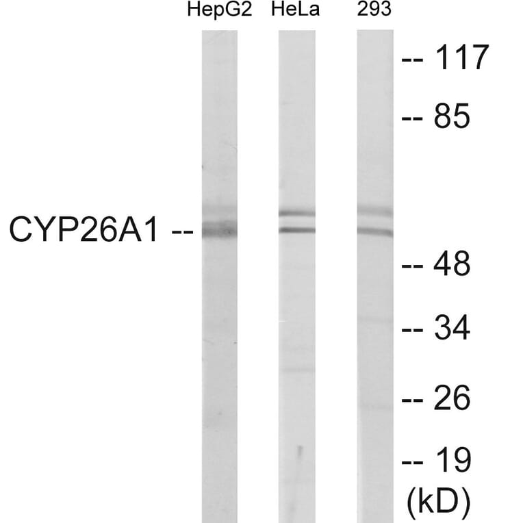 Western Blot - Cytochrome P45 026A1 Cell Based ELISA Kit (CB6125) - Antibodies.com