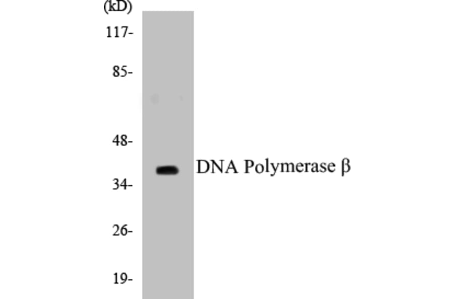 Western Blot - DNA Polymerase beta Cell Based ELISA Kit (CB5207) - Antibodies.com