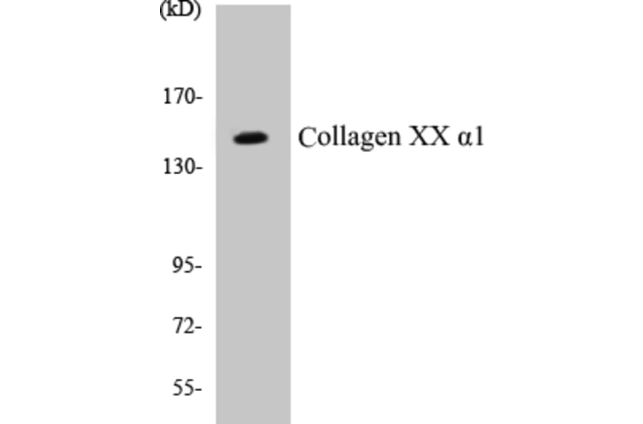 Western Blot - Collagen XX alpha 1 Cell Based ELISA Kit (CB5160) - Antibodies.com