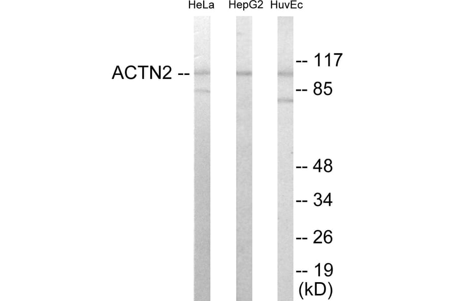 Western Blot - Actinin alpha 2 + 3 Cell Based ELISA Kit (CB5880) - Antibodies.com