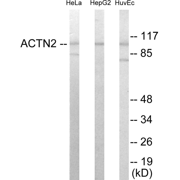 Western Blot - Actinin alpha 2 + 3 Cell Based ELISA Kit (CB5880) - Antibodies.com