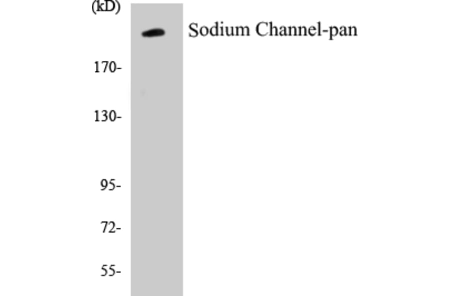 Western Blot - Sodium Channel-pan Cell Based ELISA Kit (CB5645) - Antibodies.com
