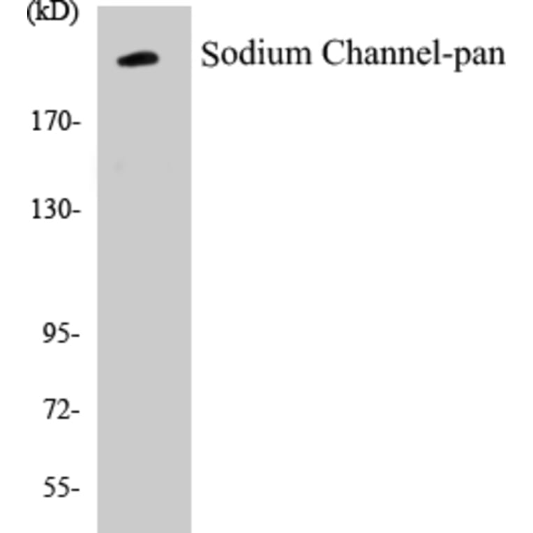 Western Blot - Sodium Channel-pan Cell Based ELISA Kit (CB5645) - Antibodies.com