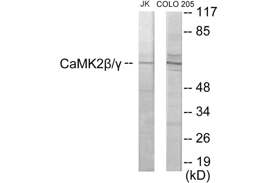 Western Blot - CaMK2 beta + gamma Cell Based ELISA Kit (CB5994) - Antibodies.com