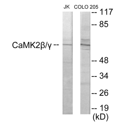 Western Blot - CaMK2 beta + gamma Cell Based ELISA Kit (CB5994) - Antibodies.com