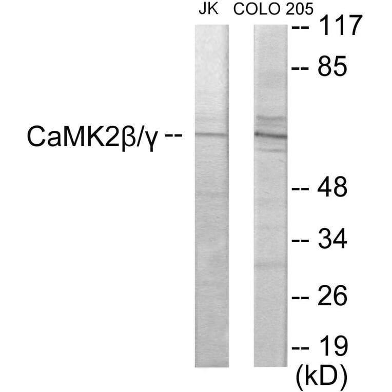 Western Blot - CaMK2 beta + gamma Cell Based ELISA Kit (CB5994) - Antibodies.com