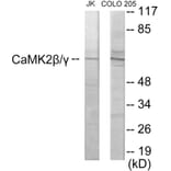 Western Blot - CaMK2 beta + gamma Cell Based ELISA Kit (CB5994) - Antibodies.com