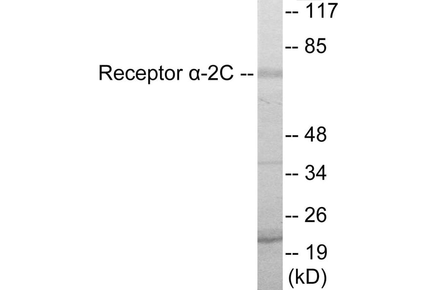 Western Blot - Adrenergic Receptor alpha 2C Cell Based ELISA Kit (CB5852) - Antibodies.com