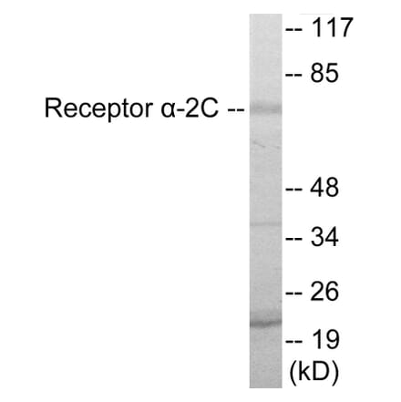 Western Blot - Adrenergic Receptor alpha 2C Cell Based ELISA Kit (CB5852) - Antibodies.com