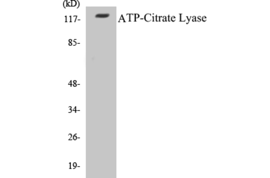 Western Blot - ATP-Citrate Lyase Cell Based ELISA Kit (CB5059) - Antibodies.com