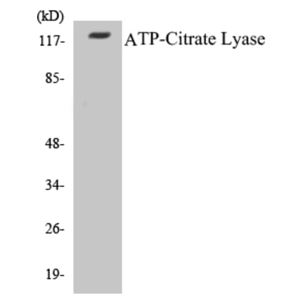 Western Blot - ATP-Citrate Lyase Cell Based ELISA Kit (CB5059) - Antibodies.com