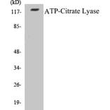 Western Blot - ATP-Citrate Lyase Cell Based ELISA Kit (CB5059) - Antibodies.com