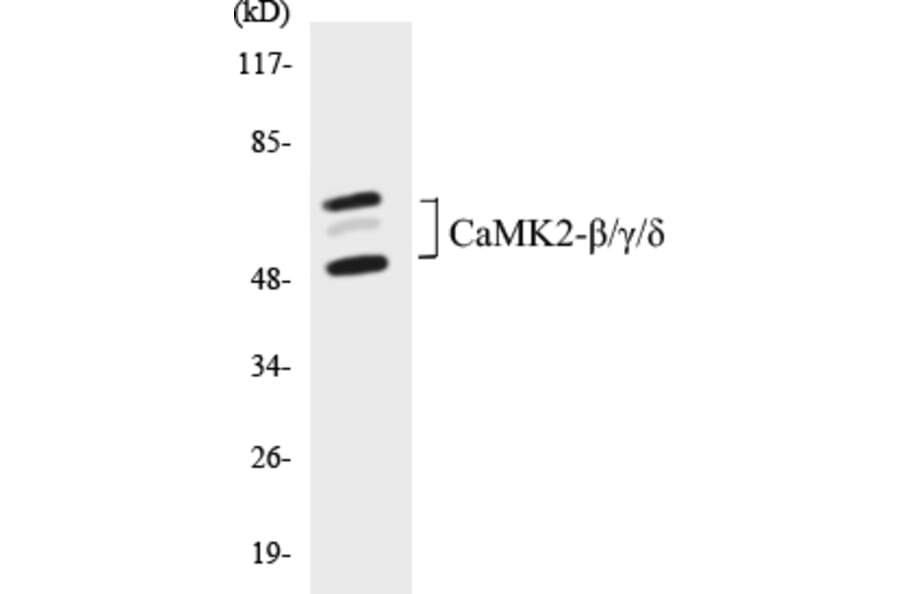 Western Blot - CaMK2 beta + gamma + delta Cell Based ELISA Kit (CB5093) - Antibodies.com