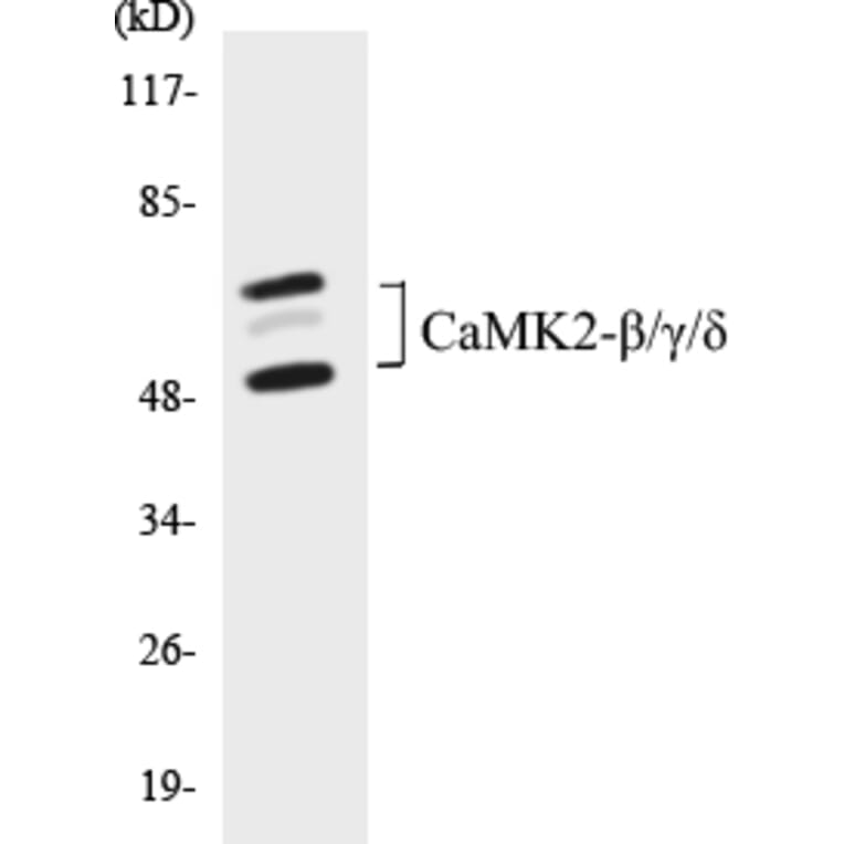 Western Blot - CaMK2 beta + gamma + delta Cell Based ELISA Kit (CB5093) - Antibodies.com