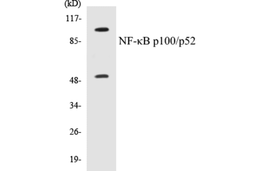 Western Blot - NFkB p100 / p52 Cell Based ELISA Kit (CB5487) - Antibodies.com