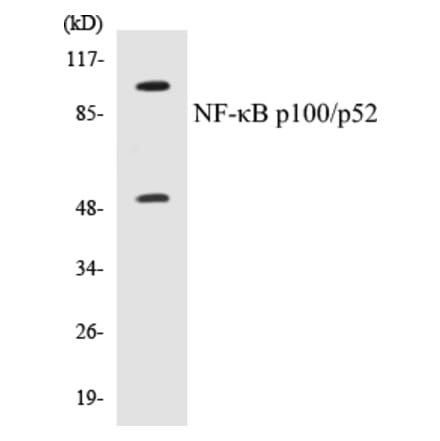Western Blot - NFkB p100 / p52 Cell Based ELISA Kit (CB5487) - Antibodies.com
