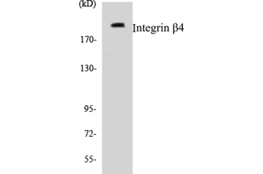 Western Blot - Integrin beta 4 Cell Based ELISA Kit (CB5372) - Antibodies.com