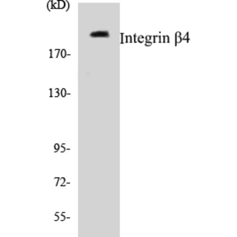 Western Blot - Integrin beta 4 Cell Based ELISA Kit (CB5372) - Antibodies.com