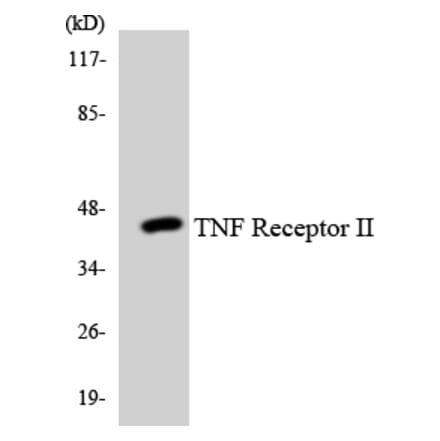 Western Blot - TNF Receptor II Cell Based ELISA Kit (CB5854) - Antibodies.com