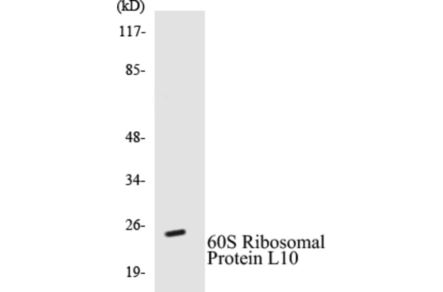 Western Blot - 60S Ribosomal Protein L10 Cell Based ELISA Kit (CB5010) - Antibodies.com