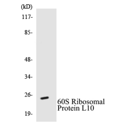 Western Blot - 60S Ribosomal Protein L10 Cell Based ELISA Kit (CB5010) - Antibodies.com