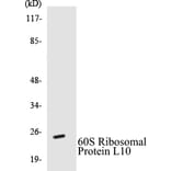 Western Blot - 60S Ribosomal Protein L10 Cell Based ELISA Kit (CB5010) - Antibodies.com