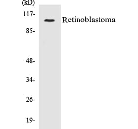 Western Blot - Retinoblastoma Cell Based ELISA Kit (CB5606) - Antibodies.com