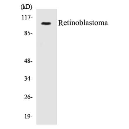 Western Blot - Retinoblastoma Cell Based ELISA Kit (CB5606) - Antibodies.com