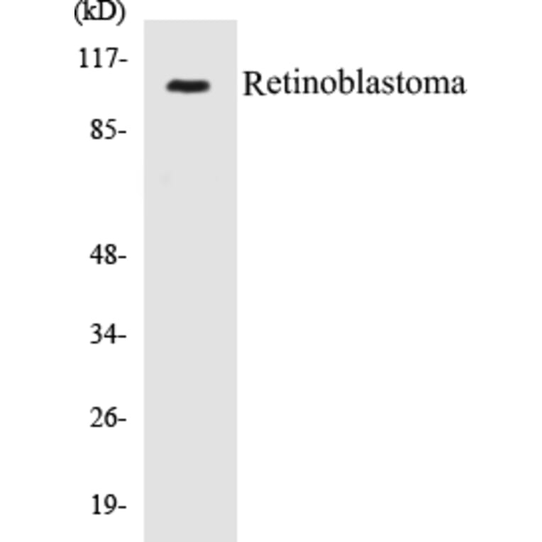 Western Blot - Retinoblastoma Cell Based ELISA Kit (CB5606) - Antibodies.com