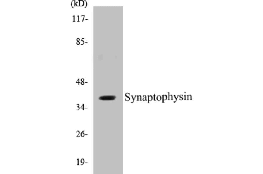 Western Blot - Synaptophysin Cell Based ELISA Kit (CB5669) - Antibodies.com