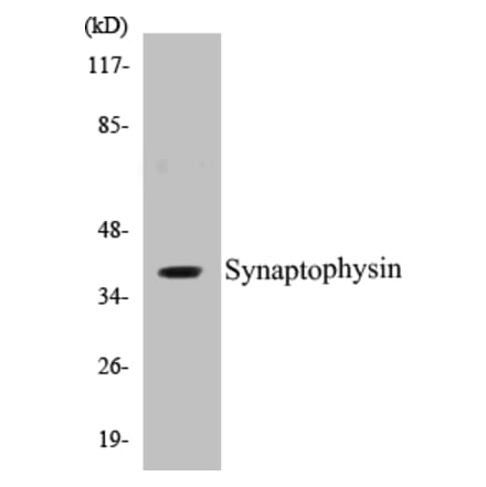 Western Blot - Synaptophysin Cell Based ELISA Kit (CB5669) - Antibodies.com