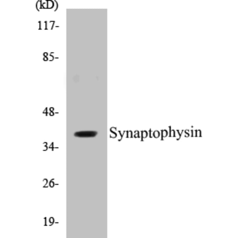Western Blot - Synaptophysin Cell Based ELISA Kit (CB5669) - Antibodies.com