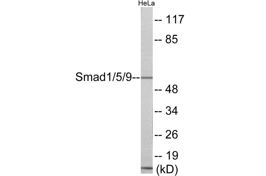 Western Blot - Smad1 + 5 + 9 Cell Based ELISA Kit (CB6033) - Antibodies.com