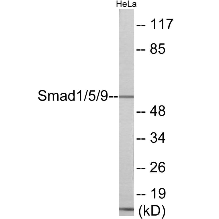 Western Blot - Smad1 + 5 + 9 Cell Based ELISA Kit (CB6033) - Antibodies.com