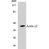 Western Blot - Actin gamma 2 Cell Based ELISA Kit (CB5021) - Antibodies.com